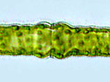 pleurotaenium_truncatum2b